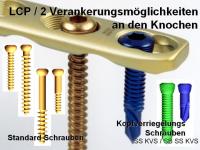 Abbildung 29: Osteosynthese