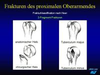 Abbildung 10: Frakturen