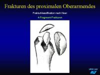 Abbildung 12: Frakturen
