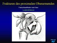 Abbildung 13: Frakturen
