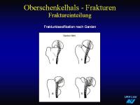 Abbildung 42: Frakturen
