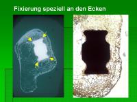 Abbildung 11: Endoprothesen