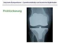 Abbildung 8: Endoprothesen