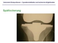 Abbildung 9: Endoprothesen