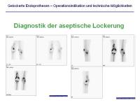 Abbildung 12: Endoprothesen
