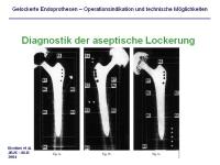 Abbildung 13: Endoprothesen