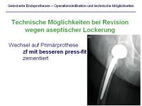 Abbildung 17: Endoprothesen