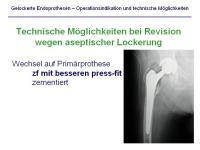 Abbildung 18: Endoprothesen