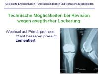 Abbildung 19: Endoprothesen