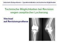 Abbildung 21: Endoprothesen