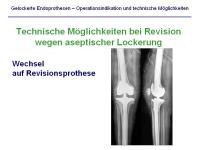 Abbildung 22: Endoprothesen