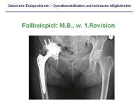 Abbildung 24: Endoprothesen