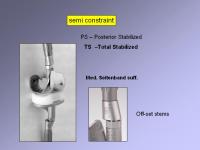 Abbildung 5: Endoprothese