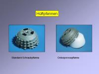 Abbildung 9: Endoprothese