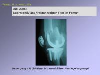 Abbildung 24: Endoprothese
