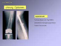 Abbildung 36: Endoprothese