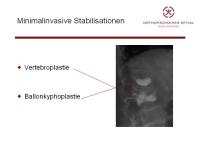 Abbildung 3: Wirbels�ule - Operation