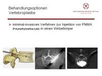 Abbildung 4: Wirbels�ule - Operation