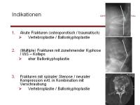 Abbildung 7: Wirbels�ule - Operation