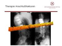 Abbildung 14: Wirbels�ule - Operation