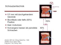 Abbildung 30: Wirbels�ule - Operation