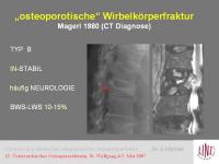 Abbildung 4: Wirbelk�rperfraktur