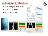 Abbildung 6: Knochenbiopsie