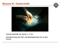 Abbildung 11: Knochenbiopsie