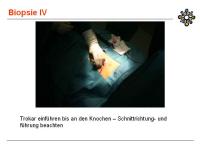 Abbildung 12: Knochenbiopsie