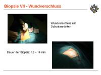 Abbildung 15: Knochenbiopsie