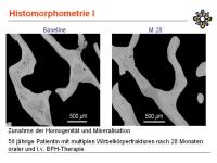 Abbildung 22: Knochenbiopsie