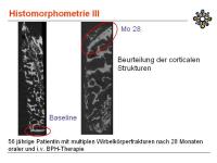 Abbildung 24: Knochenbiopsie