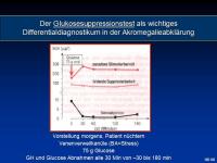 Abbildung 9: Akromegalie