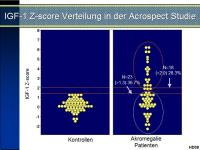 Abbildung 29: Akromegalie