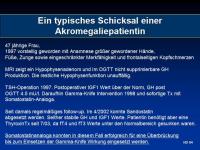 Abbildung 55: Akromegalie