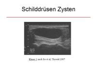 Abbildung 20: Schilddr�senknoten