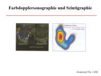 Abbildung 27: Schilddr�senknoten