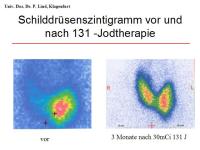Abbildung 36: Schilddr�senknoten