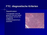 Abbildung 9: SD Ca TNM