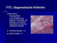 Abbildung 10: SD Ca TNM