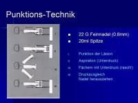 Abbildung 16: SD Ca TNM