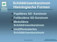 Abbildung 2: Schilddr�senkarzinom