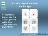 Abbildung 23: Schilddr�senkarzinom