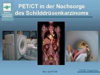 Abbildung 38: Schilddr�senkarzinom