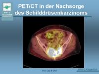 Abbildung 40: Schilddr�senkarzinom